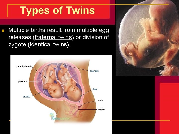 Types of Twins n Multiple births result from multiple egg releases (fraternal twins) or Types of Twins n Multiple births result from multiple egg releases (fraternal twins) or