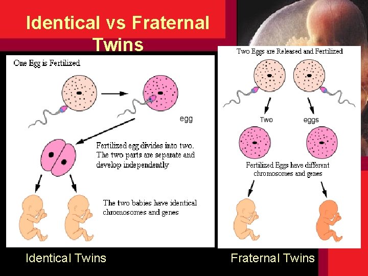 Identical vs Fraternal Twins Identical Twins Fraternal Twins Identical vs Fraternal Twins Identical Twins Fraternal Twins