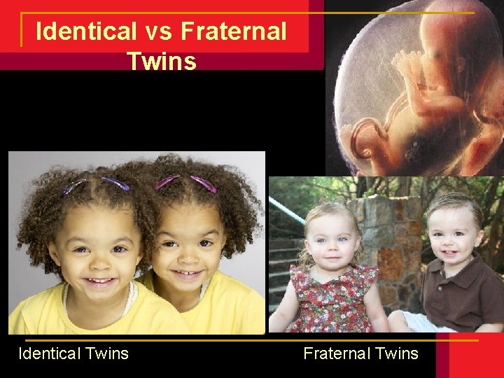 Identical vs Fraternal Twins Identical Twins Fraternal Twins Identical vs Fraternal Twins Identical Twins Fraternal Twins