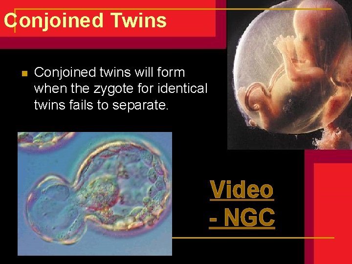 Conjoined Twins n Conjoined twins will form when the zygote for identical twins fails Conjoined Twins n Conjoined twins will form when the zygote for identical twins fails