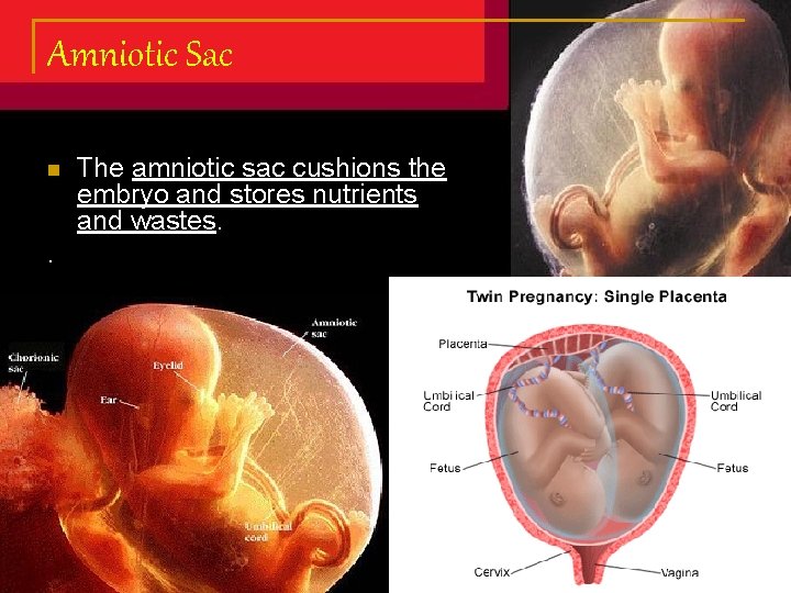 Amniotic Sac n . The amniotic sac cushions the embryo and stores nutrients and Amniotic Sac n . The amniotic sac cushions the embryo and stores nutrients and
