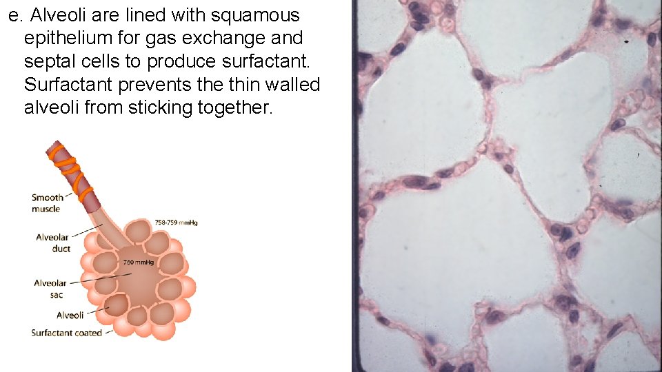 e. Alveoli are lined with squamous epithelium for gas exchange and septal cells to