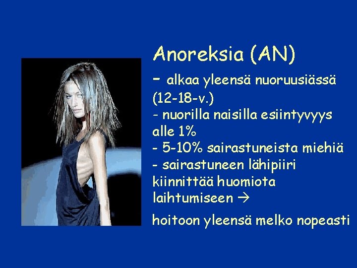  • Anoreksia (AN) - alkaa yleensä nuoruusiässä (12 -18 -v. ) - nuorilla