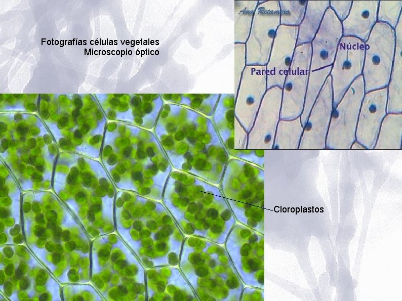 Fotografías células vegetales Microscopio óptico Cloroplastos Fotografías células vegetales Microscopio óptico Cloroplastos
