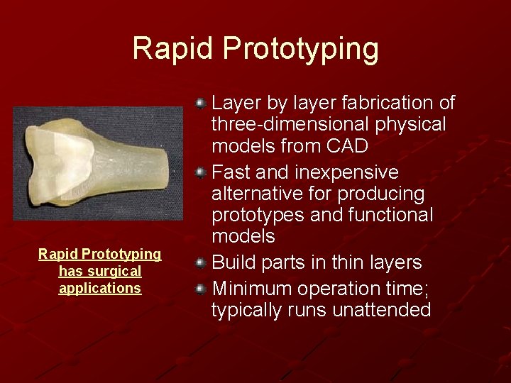 Rapid Prototyping has surgical applications Layer by layer fabrication of three-dimensional physical models from