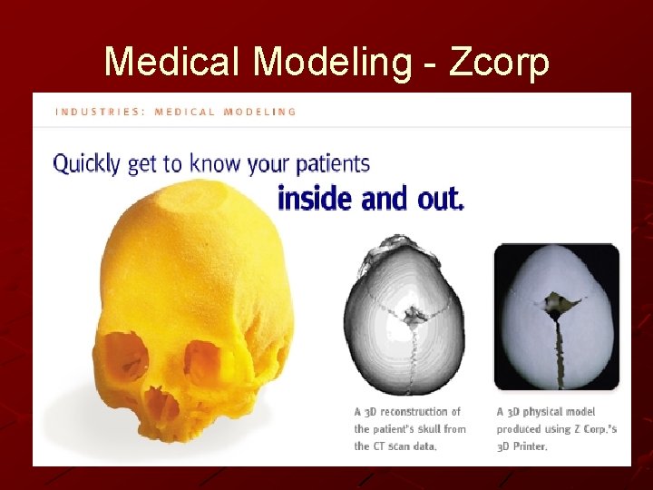 Medical Modeling - Zcorp 