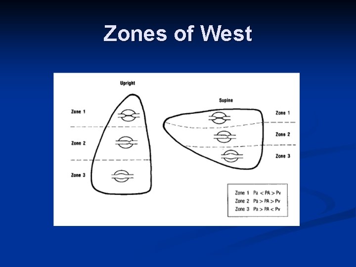 Zones of West 