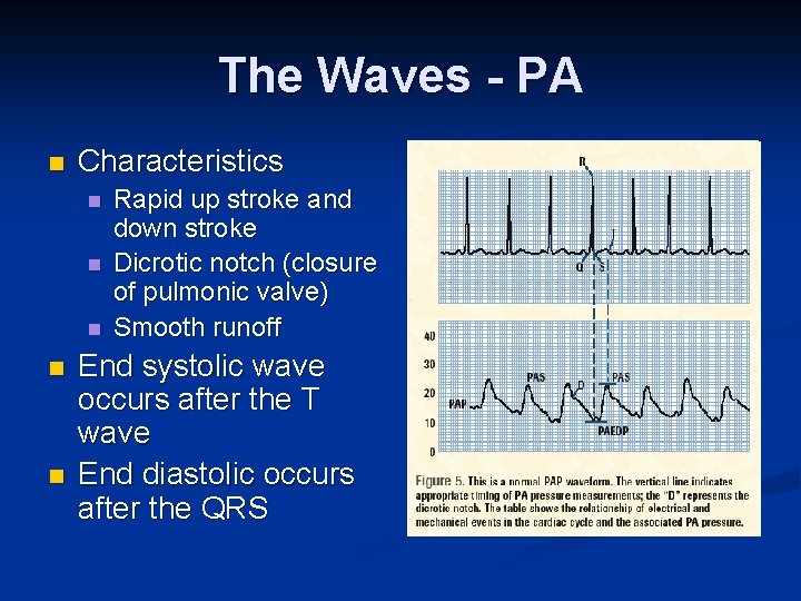 The Waves - PA n Characteristics n n n Rapid up stroke and down