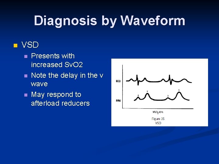 Diagnosis by Waveform n VSD n n n Presents with increased Sv. O 2