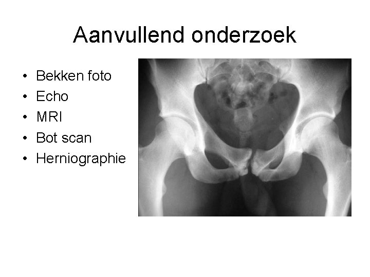 Aanvullend onderzoek • • • Bekken foto Echo MRI Bot scan Herniographie 
