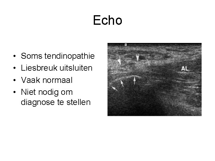 Echo • • Soms tendinopathie Liesbreuk uitsluiten Vaak normaal Niet nodig om diagnose te