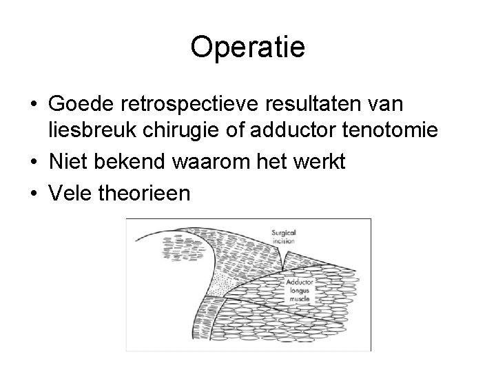 Operatie • Goede retrospectieve resultaten van liesbreuk chirugie of adductor tenotomie • Niet bekend