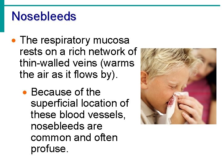 Nosebleeds · The respiratory mucosa rests on a rich network of thin-walled veins (warms