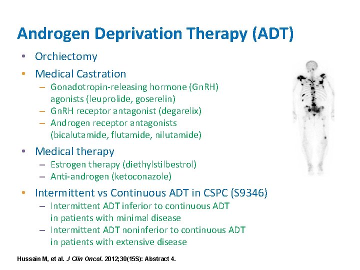 Androgen Deprivation Therapy (ADT) • Orchiectomy • Medical Castration – Gonadotropin-releasing hormone (Gn. RH)