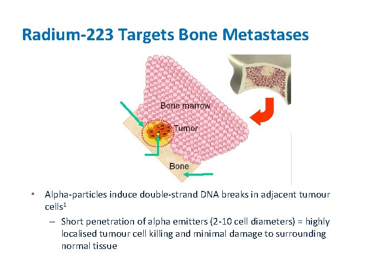 Radium-223 Targets Bone Metastases Range of alpha-particle Radium-223 Bone surface • Alpha-particles induce double-strand