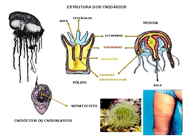 ESTRUTURA DOS CNIDÁRIOS TENTÁCULOS BOCA MEDUSA ECTODERME ENDODERME MESOGLÉIA CAVIDADE PÓLIPO NEMATOCISTO CNIDÓCITOS OU ESTRUTURA DOS CNIDÁRIOS TENTÁCULOS BOCA MEDUSA ECTODERME ENDODERME MESOGLÉIA CAVIDADE PÓLIPO NEMATOCISTO CNIDÓCITOS OU