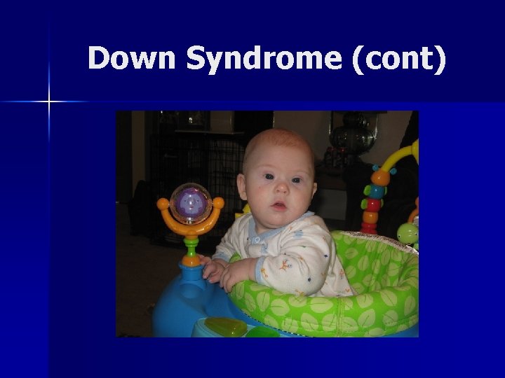 Down Syndrome (cont) 