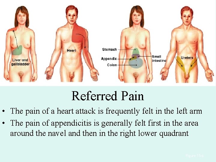 Referred Pain • The pain of a heart attack is frequently felt in the