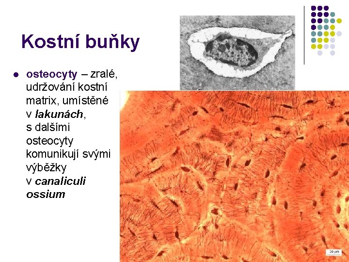Kostní buňky l osteocyty – zralé, udržování kostní matrix, umístěné v lakunách, s dalšími