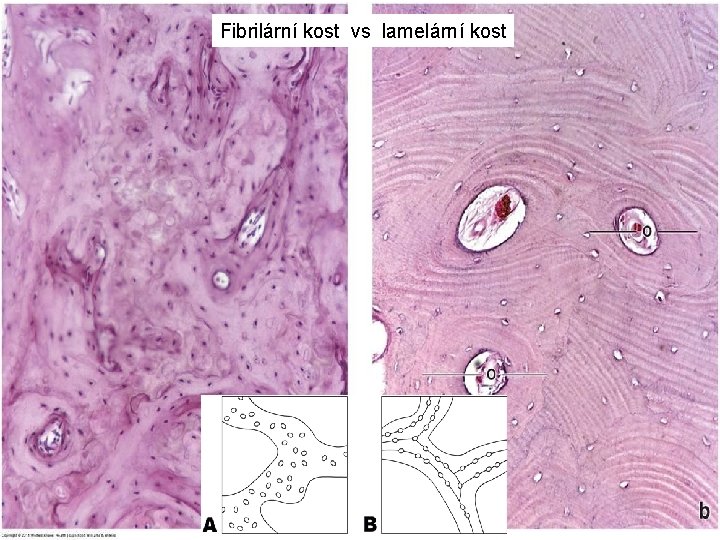 Fibrilární kost vs lamelární kost 