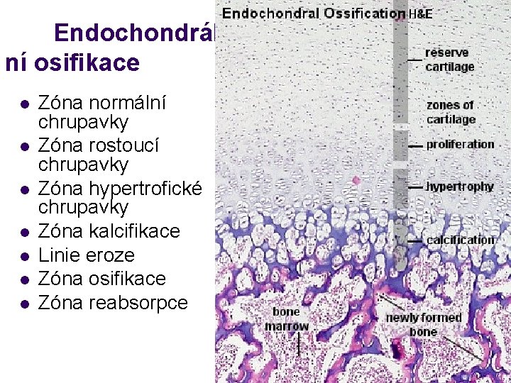 Endochondrál ní osifikace l l l l Zóna normální chrupavky Zóna rostoucí chrupavky Zóna