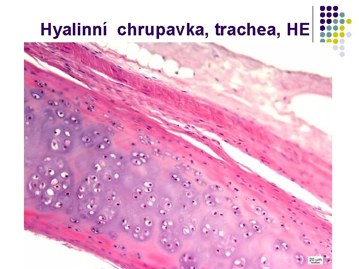 Hyalinní chrupavka, trachea, HE 