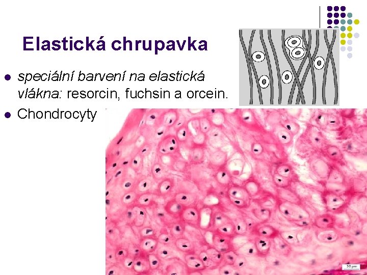 Elastická chrupavka l l speciální barvení na elastická vlákna: resorcin, fuchsin a orcein. Chondrocyty