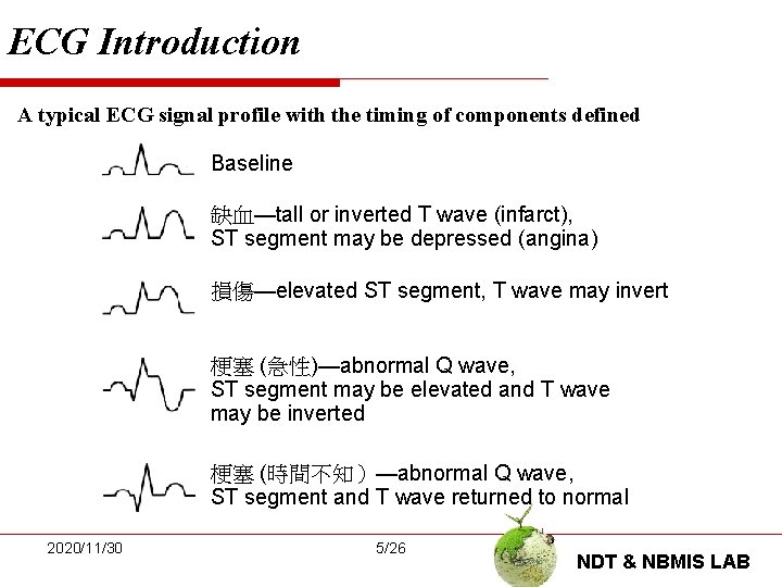 ECG Introduction A typical ECG signal profile with the timing of components defined Baseline