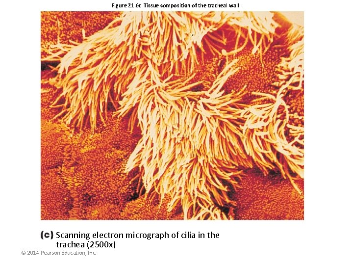 Figure 21. 6 c Tissue composition of the tracheal wall. Scanning electron micrograph of