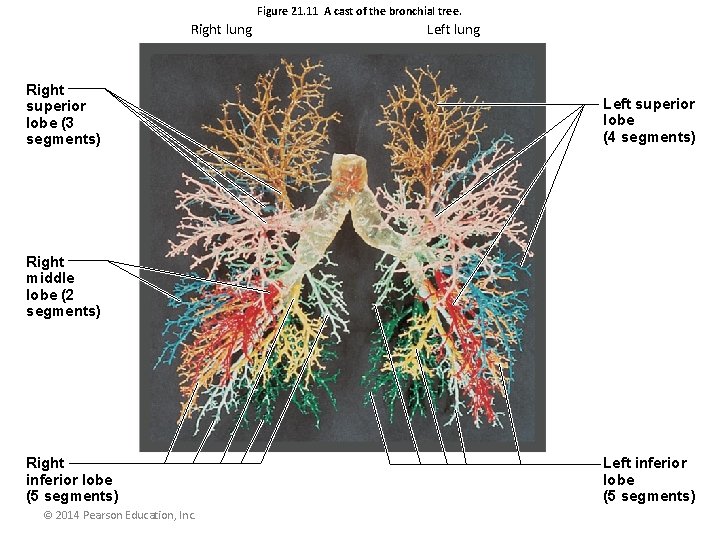 Figure 21. 11 A cast of the bronchial tree. Right lung Right superior lobe