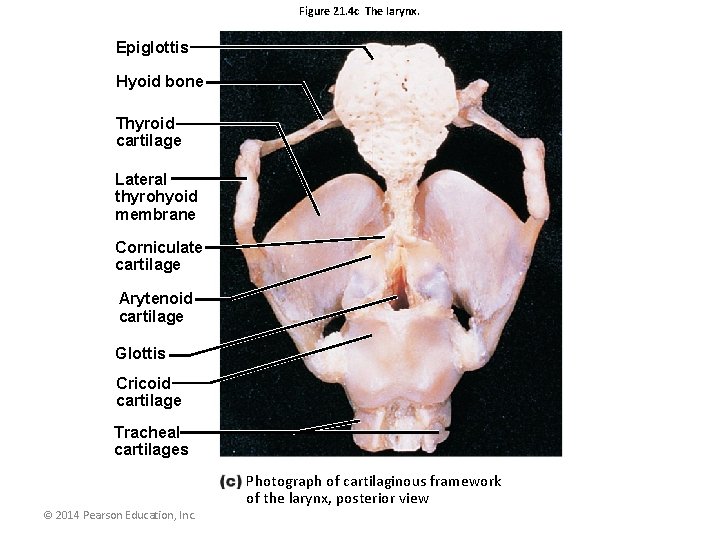 Figure 21. 4 c The larynx. Epiglottis Hyoid bone Thyroid cartilage Lateral thyrohyoid membrane