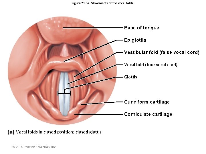 Figure 21. 5 a Movements of the vocal folds. Base of tongue Epiglottis Vestibular