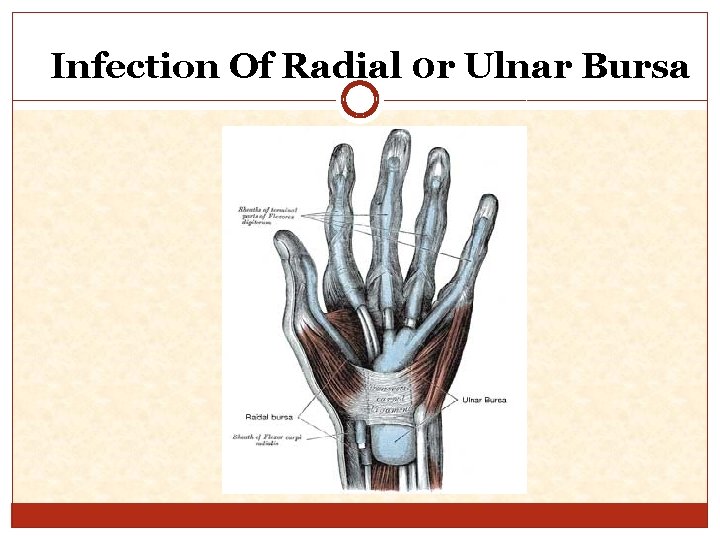 Infection Of Radial 0 r Ulnar Bursa 