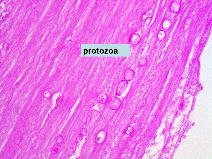 protozoa 