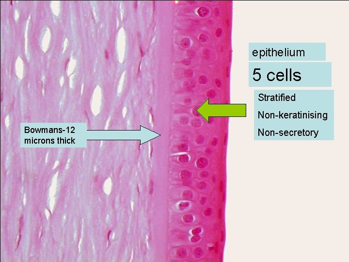 epithelium 5 cells Stratified Non-keratinising Bowmans-12 microns thick Non-secretory 