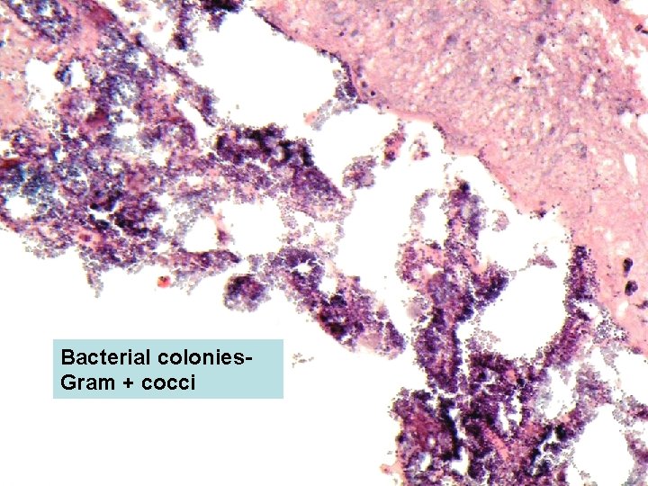 Bacterial colonies. Gram + cocci 