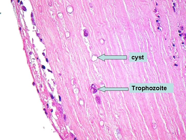 cyst Trophozoite 