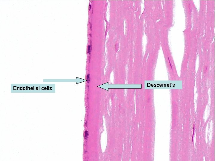 Endothelial cells Descemet’s 