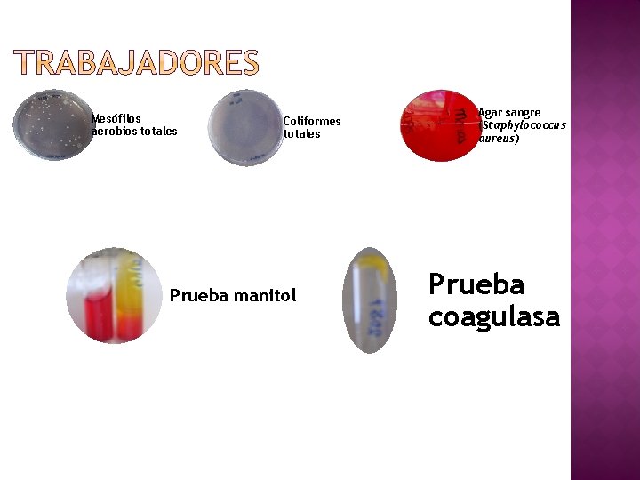 Mesófilos aerobios totales Coliformes totales Prueba manitol Agar sangre (Staphylococcus aureus) Prueba coagulasa 