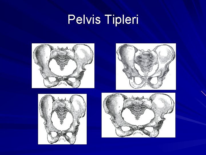 Pelvis Tipleri 