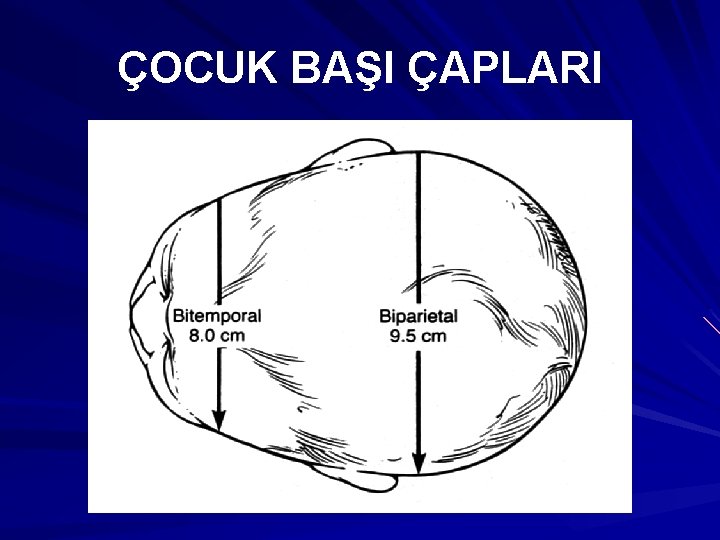 ÇOCUK BAŞI ÇAPLARI 