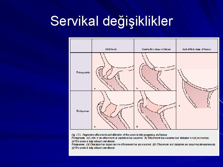 Servikal değişiklikler 