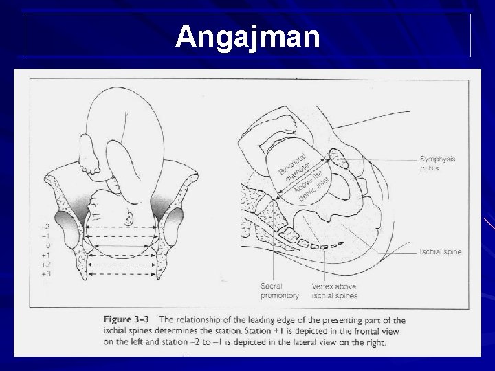 Angajman 