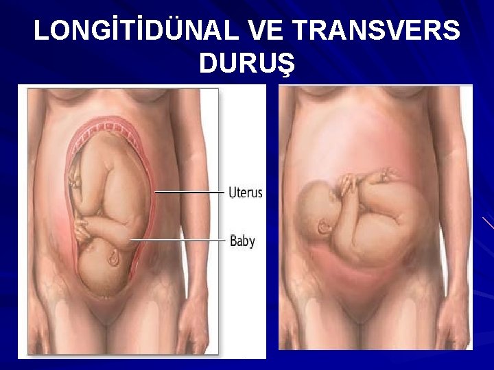 LONGİTİDÜNAL VE TRANSVERS DURUŞ 