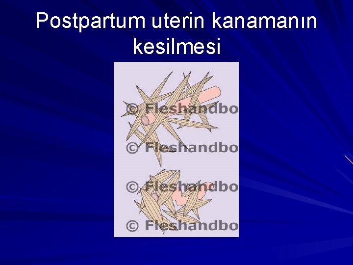 Postpartum uterin kanamanın kesilmesi 