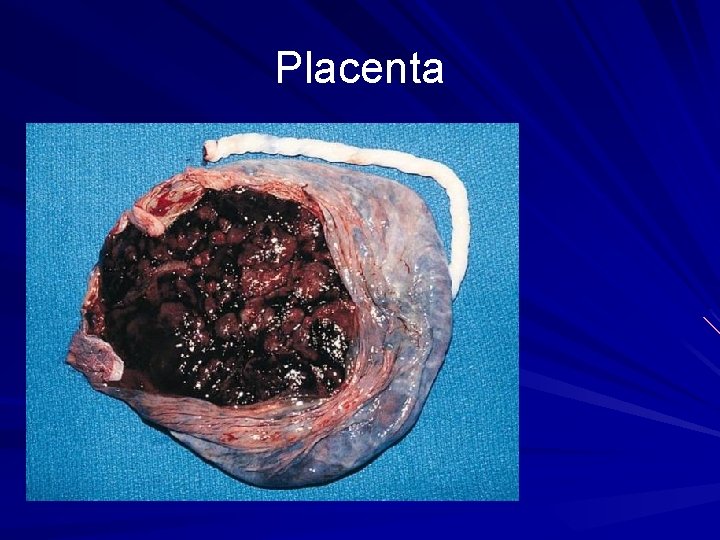 Placenta 