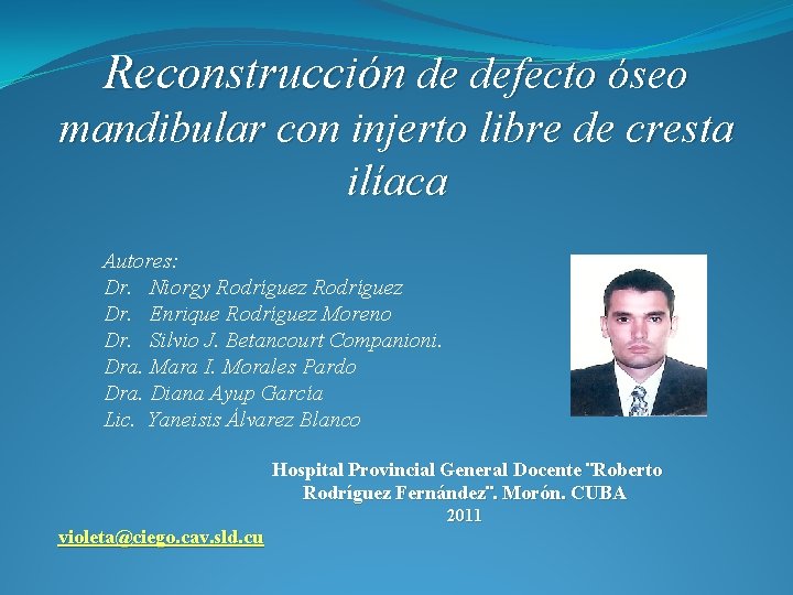 Reconstrucción de defecto óseo mandibular con injerto libre de cresta ilíaca Autores: Dr. Niorgy