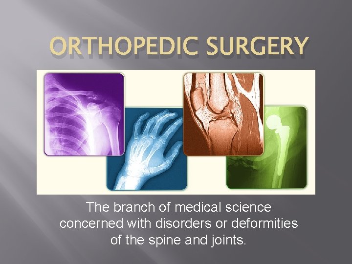 ORTHOPEDIC SURGERY The branch of medical science concerned with disorders or deformities of the