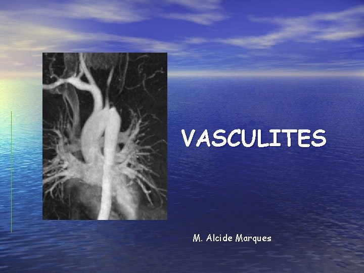 VASCULITES M. Alcide Marques 
