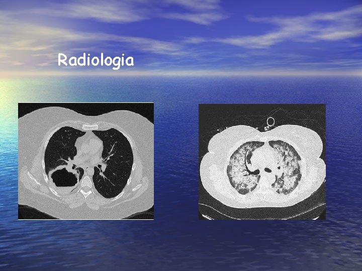 Radiologia 